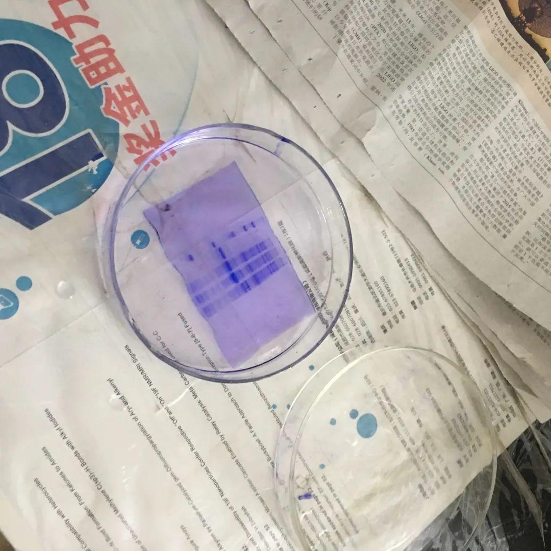 【2020届DP学子风采录】用显微镜看世界——从渺小细胞到漫漫人生图片_8388607 【2020届DP学子风采录】用显微镜看世界——从渺小细胞到漫漫人生图片_8388607