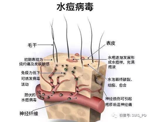 2018年度水痘疫苗接种告家长书图片_3