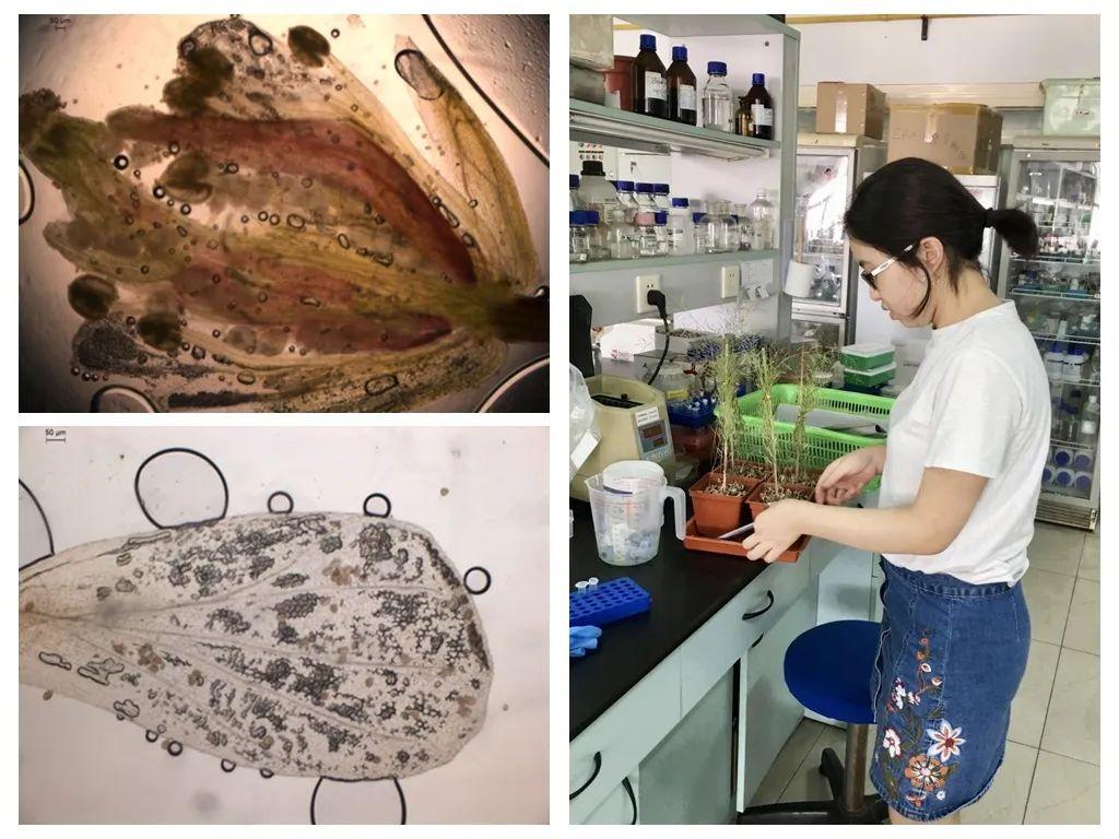 【2020届DP学子风采录】用显微镜看世界——从渺小细胞到漫漫人生图片_1048575 【2020届DP学子风采录】用显微镜看世界——从渺小细胞到漫漫人生图片_1048575