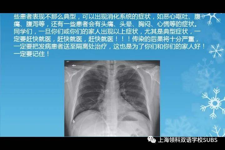 领科双语“云”科技节ing | 七年级“云上”防疫科普小课堂上的小老师和大老师图片_2097151
