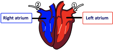 IGCSE生物知识点精讲：三分钟带你认识pulmonary vein and vena cava内容图片_3