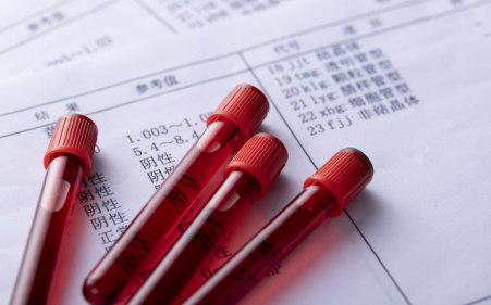 常考ALEVEL生物知识点讲解：血液循环内容图片_1